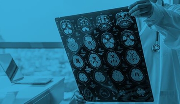 Traumatic Brain Injuries